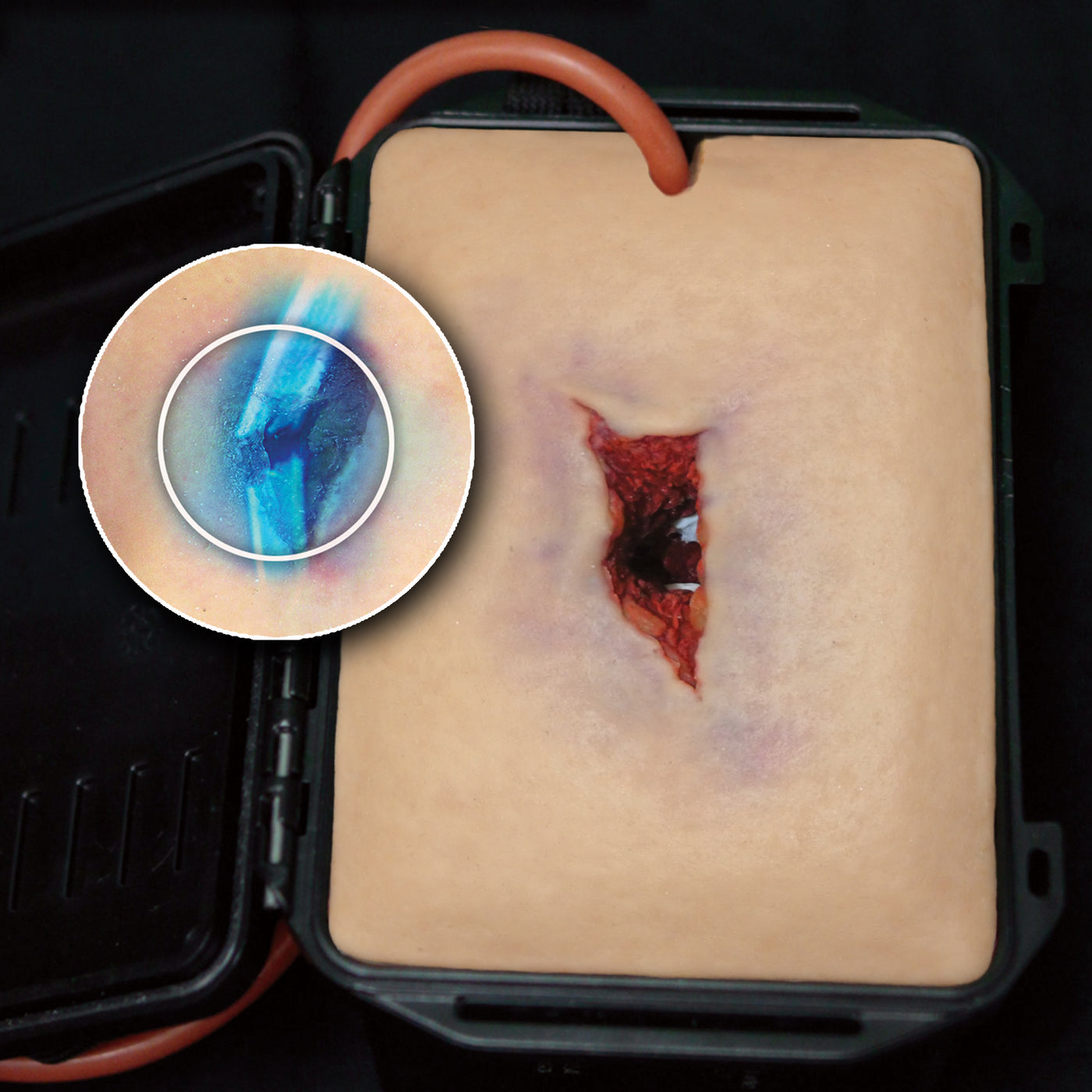 Schrapnel Injuries SHRAPNEL WOUND IN A BOX® – Techline Trauma