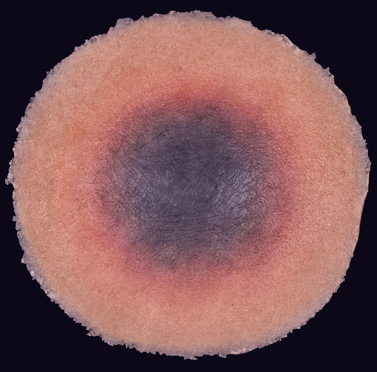 Deep Tissue Injury – Techline Trauma