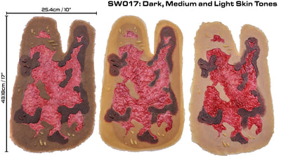 3rd Degree Thermal Arm Burn - Debrided