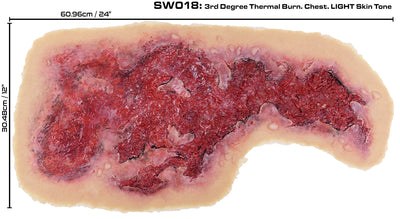 3rd Degree Thermal Chest Burn