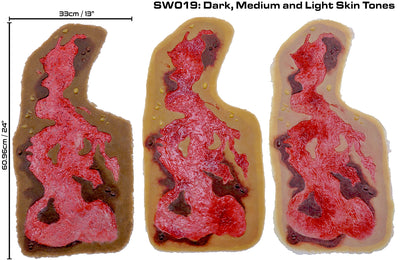 3rd Degree Thermal Chest Burn - Debrided
