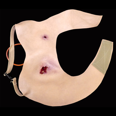 Gunshot Wound Clavicle (Right)