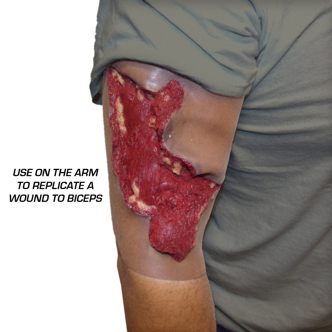Avulsion to Calf used on Arm