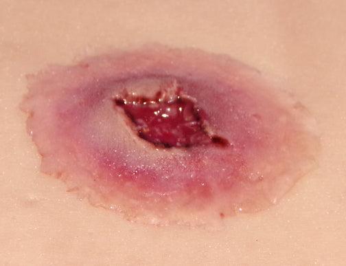 GS Entry Wound- Large
