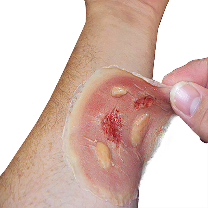ThermalBurn_med_SW010_9d125731